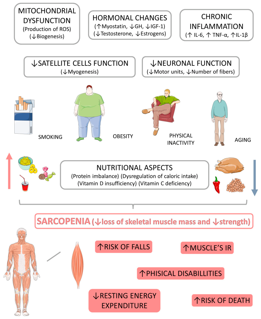 Sarcopenia-related risk factors by MDPI.com